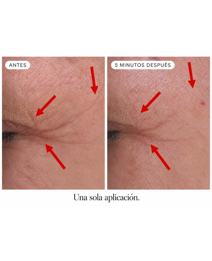 Contorno de ojos antes y 5 minutos después de una sola aplicación de la Fórmula DMAE Alisadora de LUMINHAZ: arrugas de expresión visiblemente suavizadas