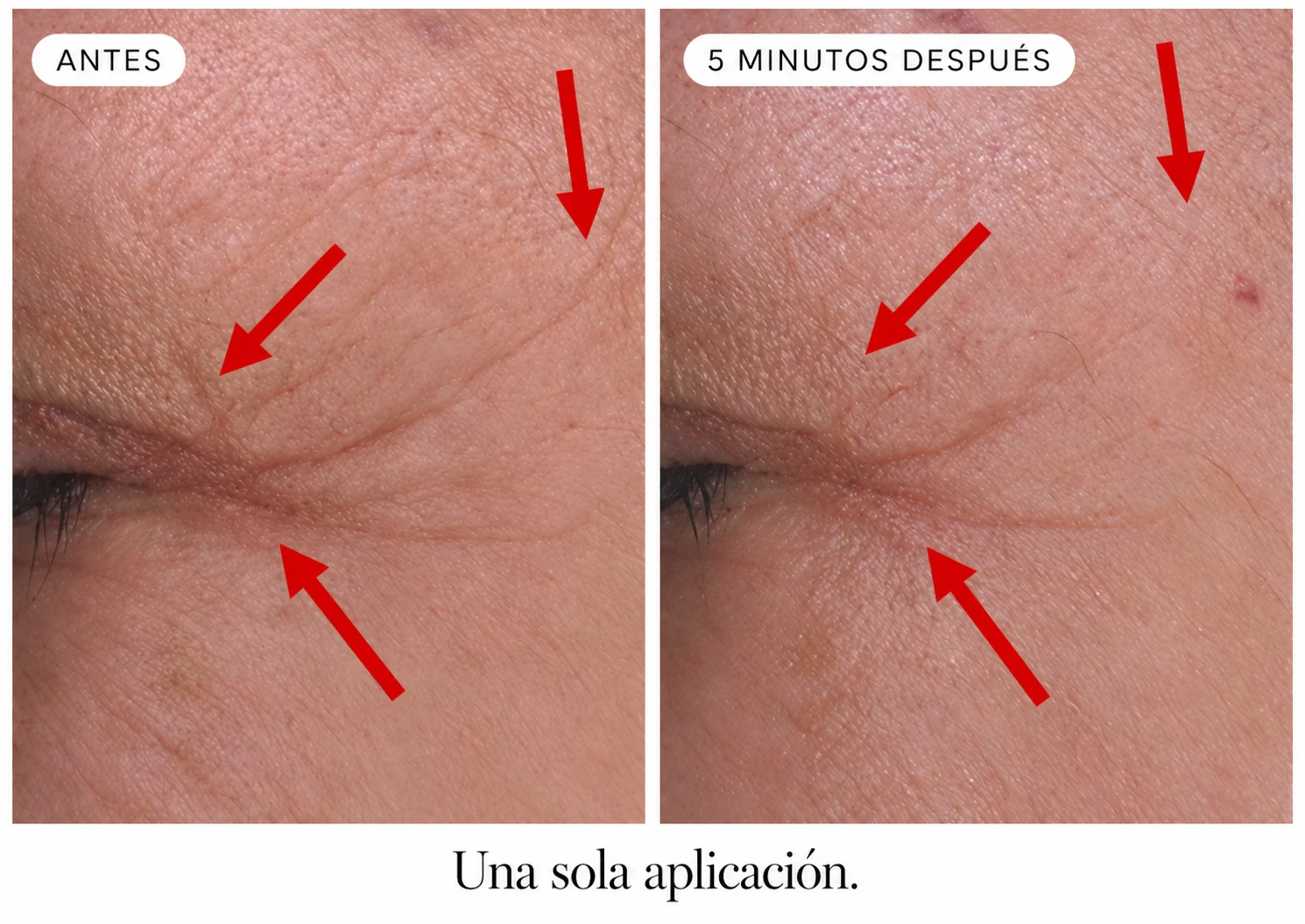 Contorno de ojos antes y 5 minutos después de una sola aplicación del activo TENS’UP™: arrugas de expresión visiblemente atenuadas